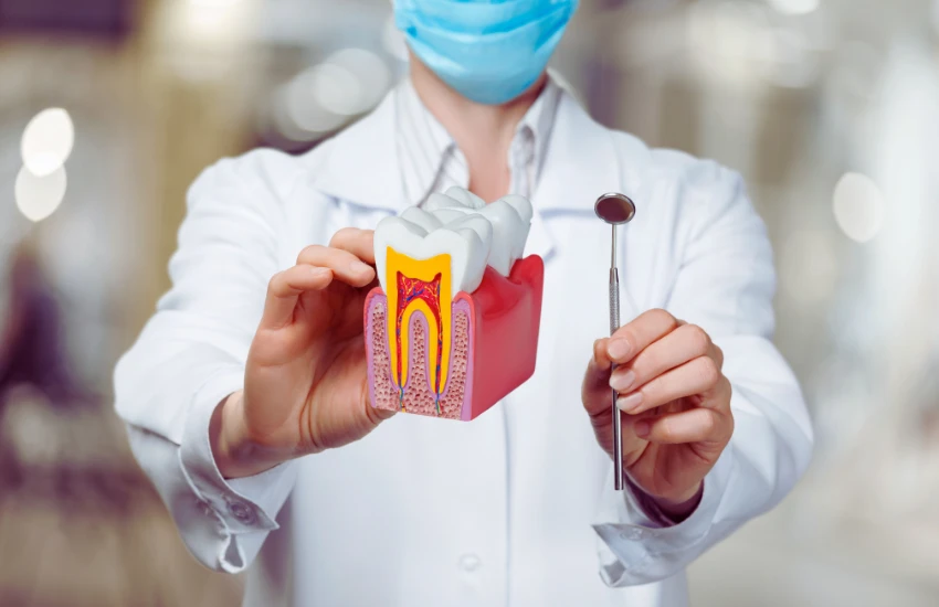 Endodontia - Tratamento de Canal